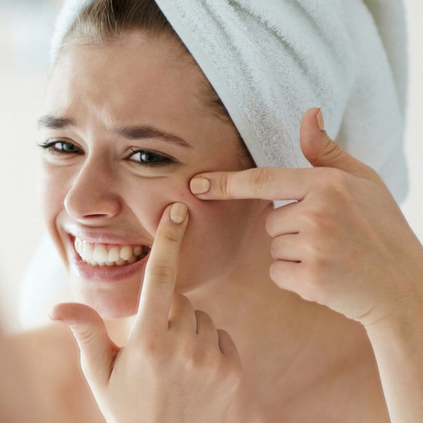 All About Acne: Myths, Facts and Best Advice