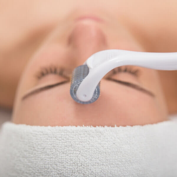 Not Sure About Derma Rolling? Here's Everything You Need to Know