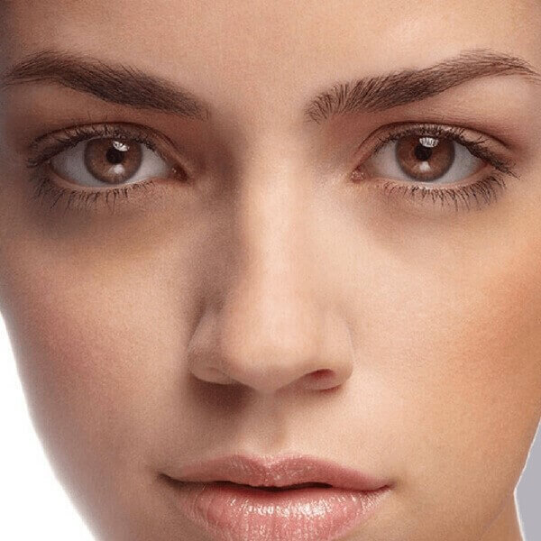 Want to Remove Dark Circles Under Your Eyes? Here’s How.